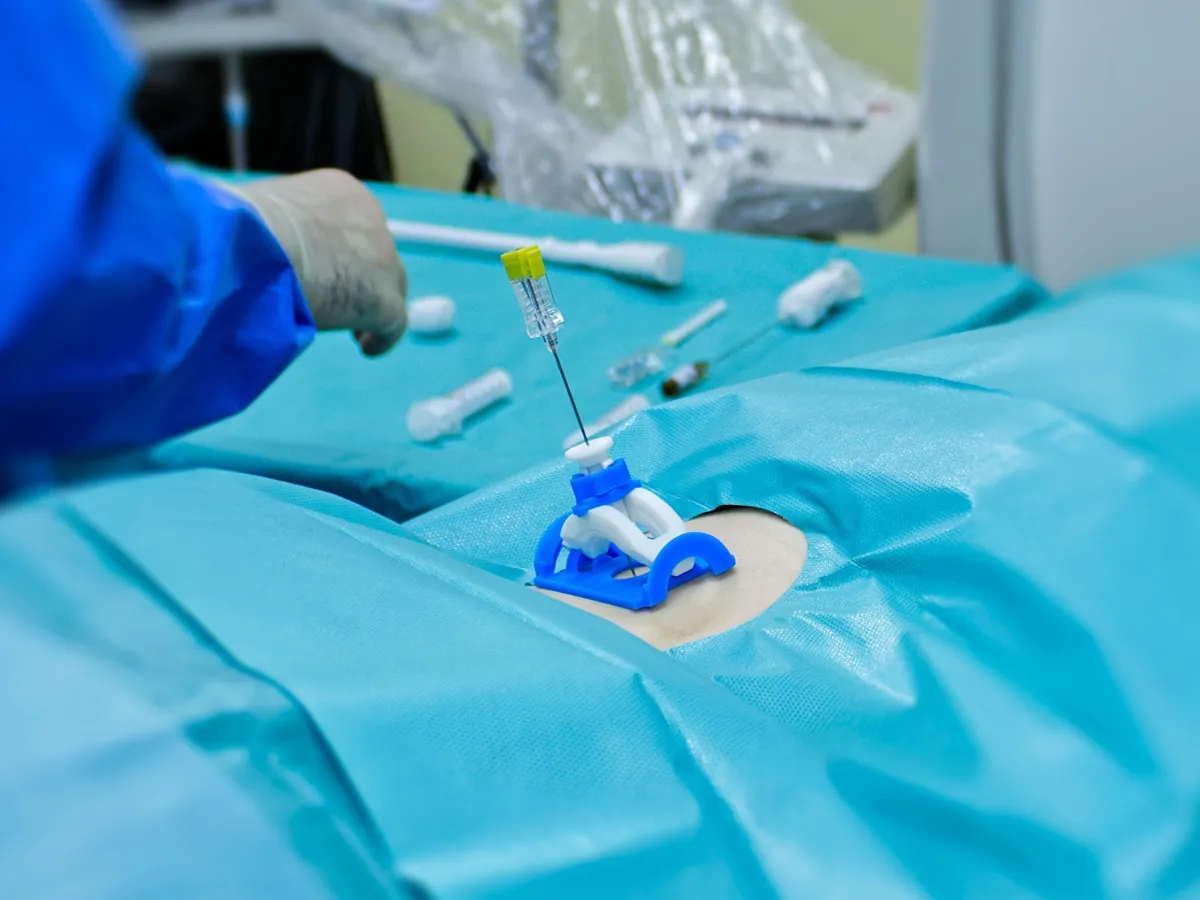 FlexLine Nadelführung für bildgeführte Eingriffe zur Krebsdiagnose und -therapie (© InLine-Med GmbH)