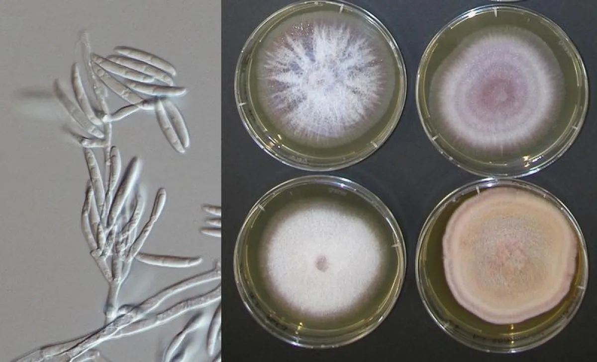 Ein Schimmelpilz der Gattung Fusarium unter dem Mikroskop (links) und in Laborkulturen. Fusarium ist einer der wichtigsten Erreger der Pilzkeratitis. ((Bild: Nationales Referenzzentrum für Invasive Pi