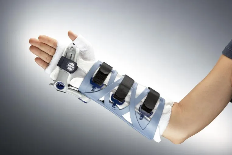 Bild: Gips ist out - Vakuum-Stützsystem jetzt auch für Radiusfrakturen - VACO®hand