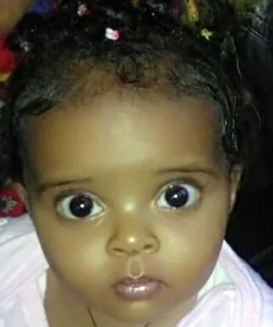 Fermosi muss sterben wenn sie nicht am Herzen operiert wird Bild: Fermosi muss sterben wenn sie nicht am Herzen operiert wird