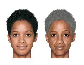 Bild: Würden Sie rauchen, wenn Sie heute sehen könnten, wie Sie in 20 Jahren als Raucher aussehen werden?