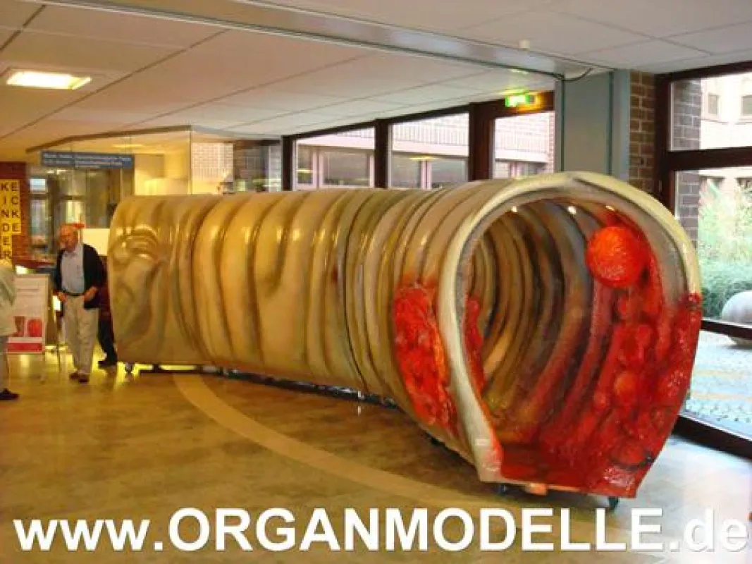 Das begehbare Darmmodell