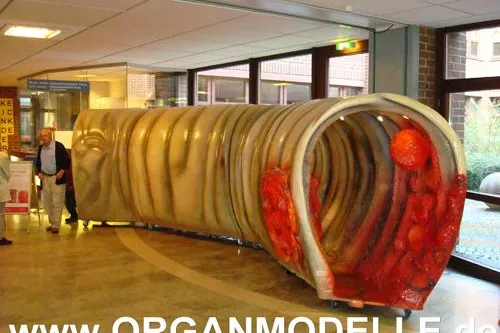 Bild: organmodelle.de – das Darmmodell - Tag der offenen Tür zur Darmkrebsvorsorge am 09.11.2008