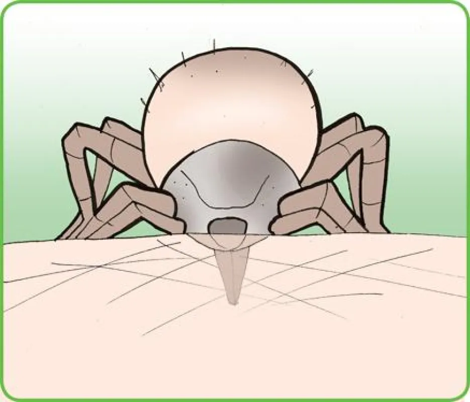 Zeckenstiche können Krankheiten wie FSME und Borreliose übertragen