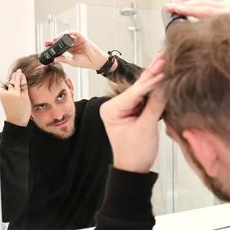 Bild: Haartransplantation: diese Stars sind betroffen!