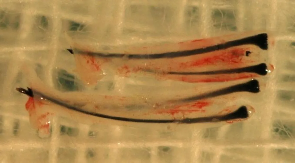Zwei frisch extrahierte double- follicular units