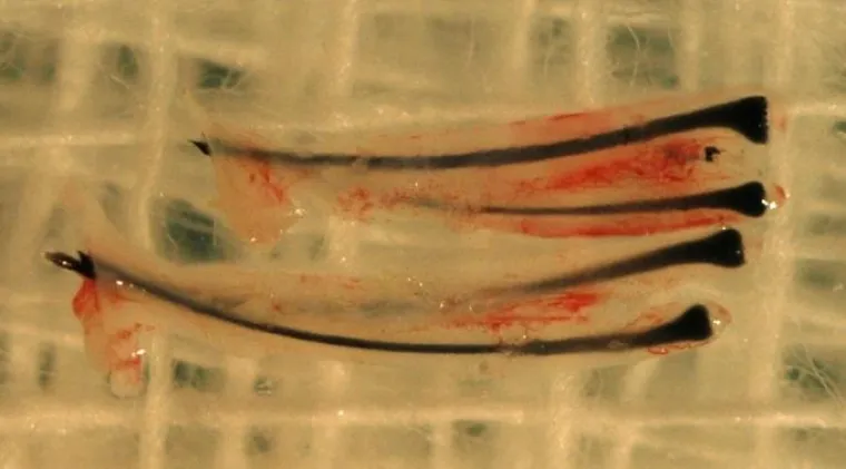 Bild: Haartransplantation