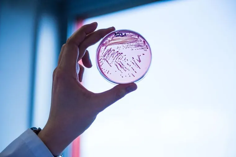 Bild: Antibiotic resistance: a strain of multidrug-resistant Escherichia coli is on the rise