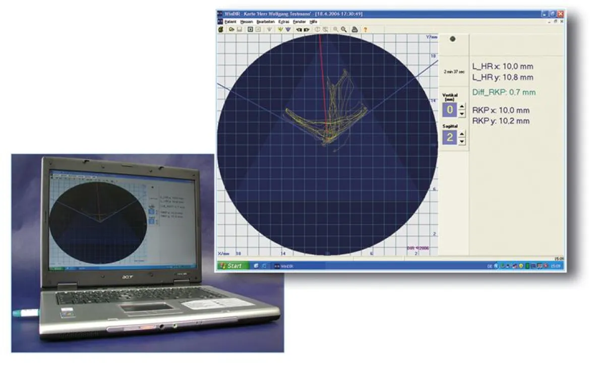 Computerunterstützte Analyse des Kausystems
