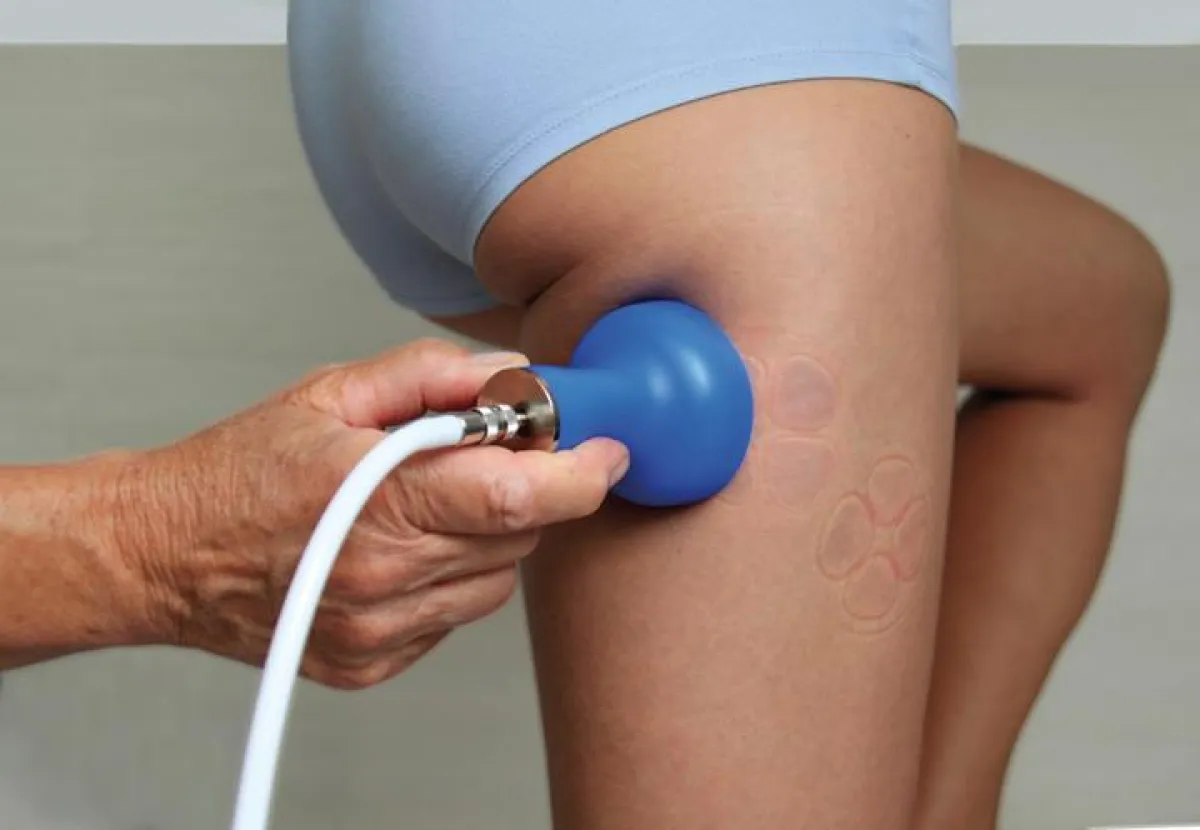 Vacuum-Massage gegen Cellulite