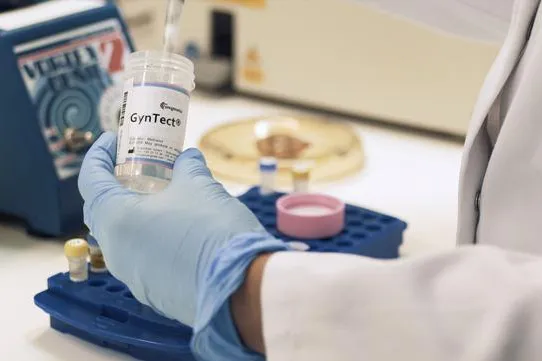 GynTect® als Prognosemarker / Wegweisende Ergebnisse möglich: Verlaufsstudie zu Gebärmutterhalskrebs startet Bild: GynTect® als Prognosemarker / Wegweisende Ergebnisse möglich: Verlaufsstudie zu Gebärmutterhalskrebs startet