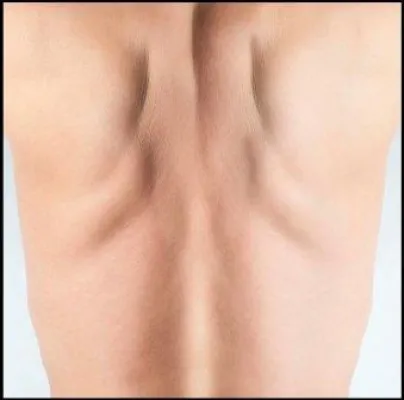 Ein starker Rücken hat keine Schmerzen Bild: Ein starker Rücken hat keine Schmerzen