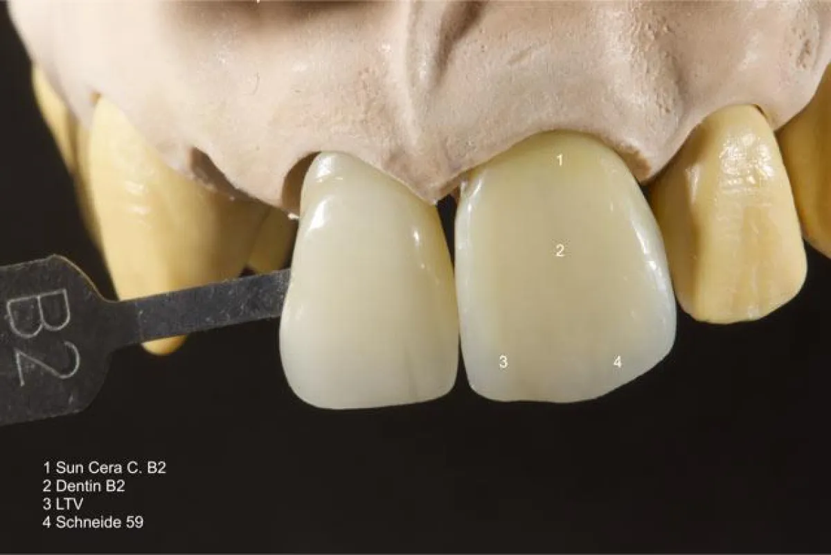 keep it simple - Perfektes Arbeiten mit Kompositematerialien