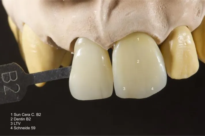 Bild: Effektivität, Individualität und ästhetische Perfektion