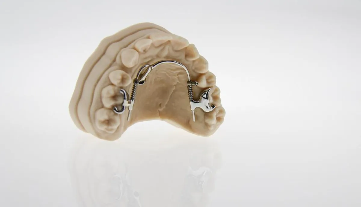 Gedrucktes Modell mit einer CAD/CAM-gefertigten kieferorthopädischen Apparatur