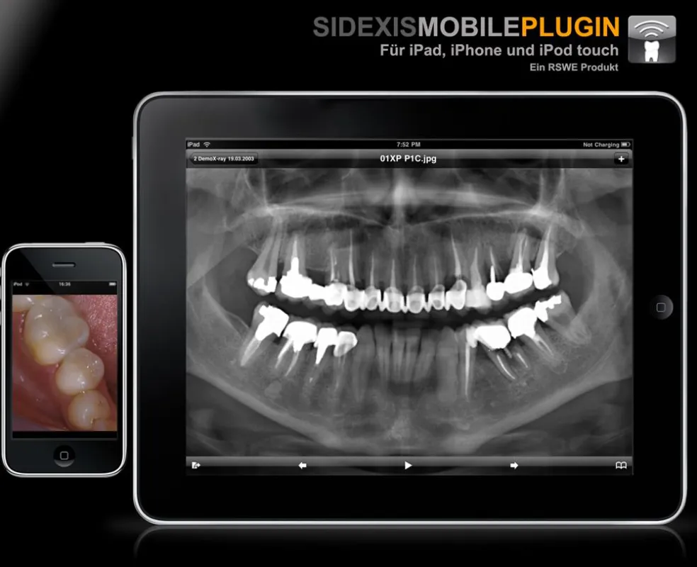 RSWE SidexisMobilePlugin mit nativer iPad® Unterstützung. Das brilliante iPad® Display mit LED Hintergrundbeleuchtung, 24,63 cm Bilddiagonale und einem sehr großen Betrachtungswinkel macht das Ansehen