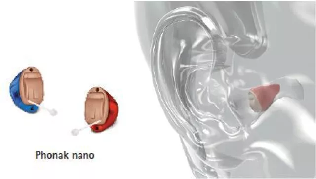 Bild: Schweizer Hersteller Phonak begeistert mit neuer einzigartiger Hörgerätetechnologie.