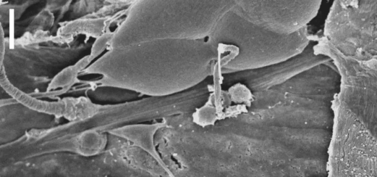 The larval Drosophila chordotonal organ seen under the scanning electron microscope. This sensory functional unit modulates the processing of mechanical stimuli by means of the latrophilin receptor. (