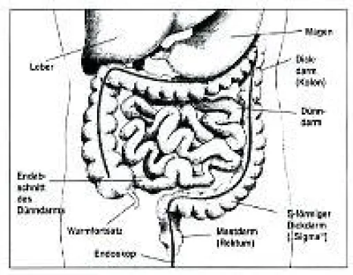 Bild: Keine Angst vor der Darmspiegelung - Deutsche Gesundheitshilfe informiert