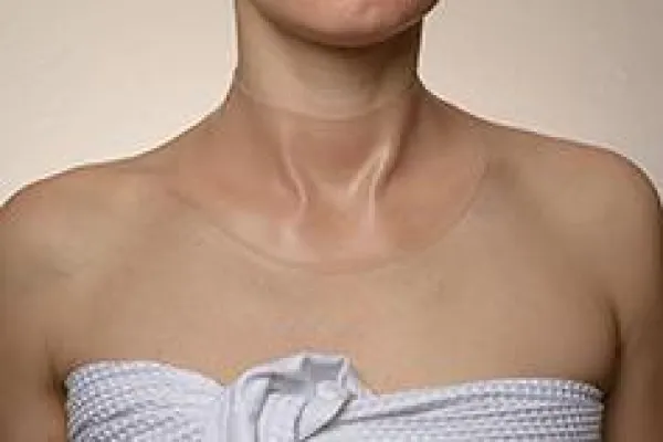 Bild: Revolutionäre Weltneuheit zur Faltenbekämpfung – Made in Germany