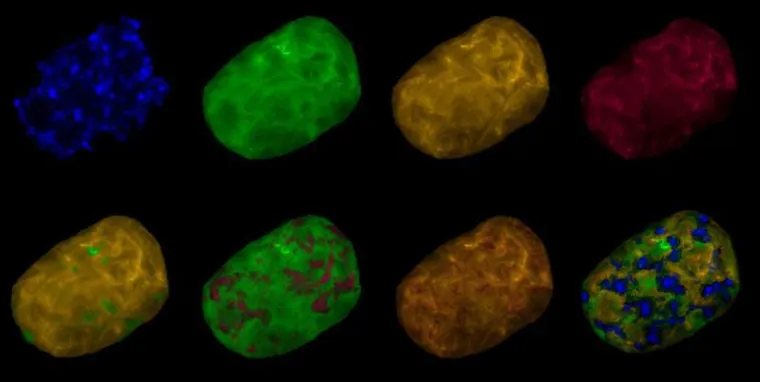 Giant bacterium contains genomes for an entire population Bild: Giant bacterium contains genomes for an entire population