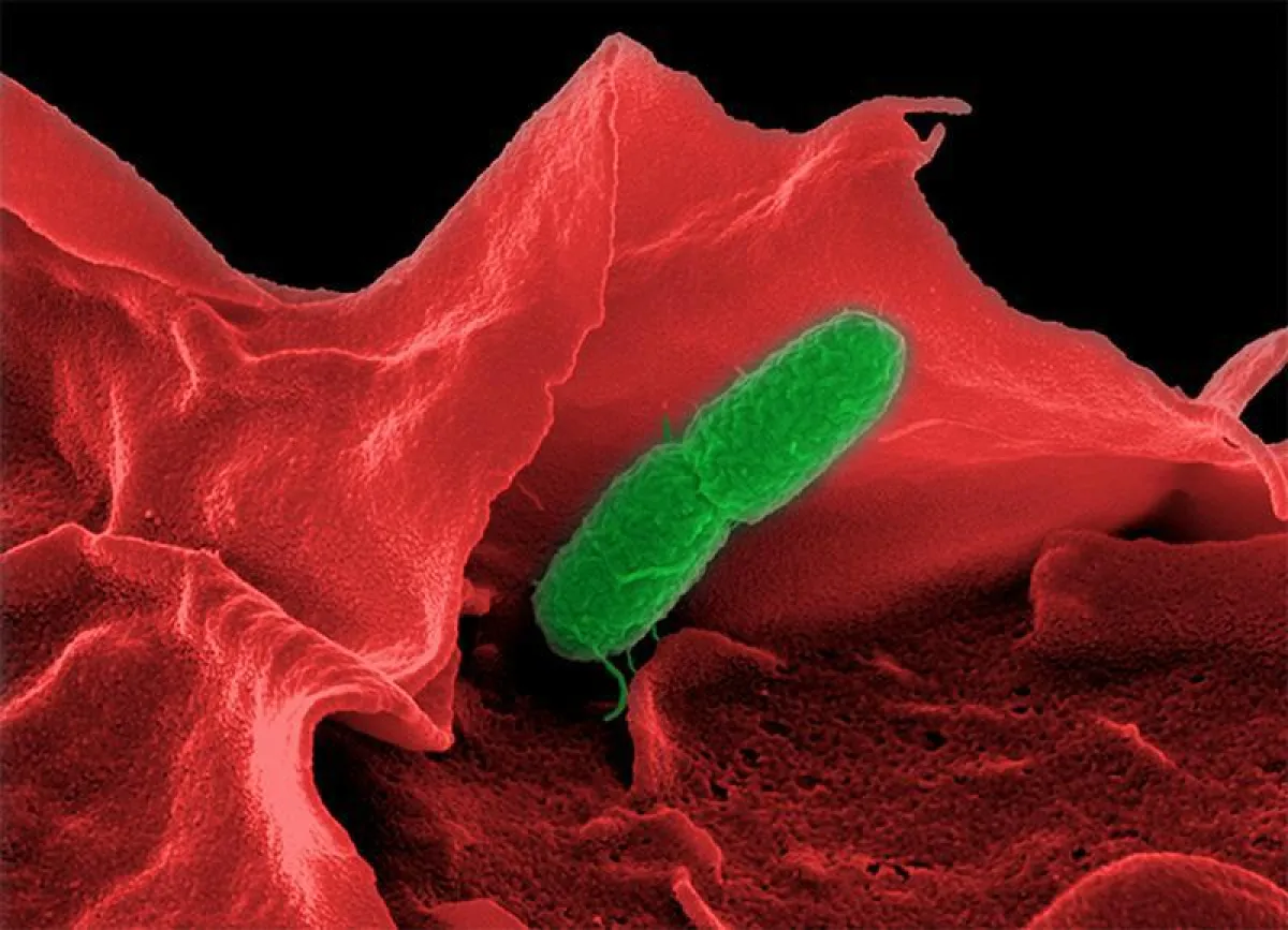Electron microscopic image of Salmonella enterica (serovar Typhimurium). (HZI/Manfred Rohde)