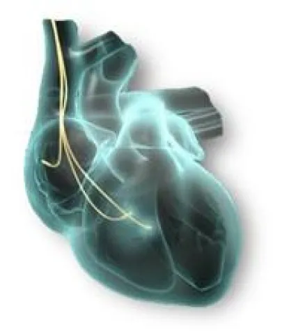 Live Implantation eines Systems für die Kardiale Kontraktilitätsmodulation (CCM) Bild: Live Implantation eines Systems für die Kardiale Kontraktilitätsmodulation (CCM)