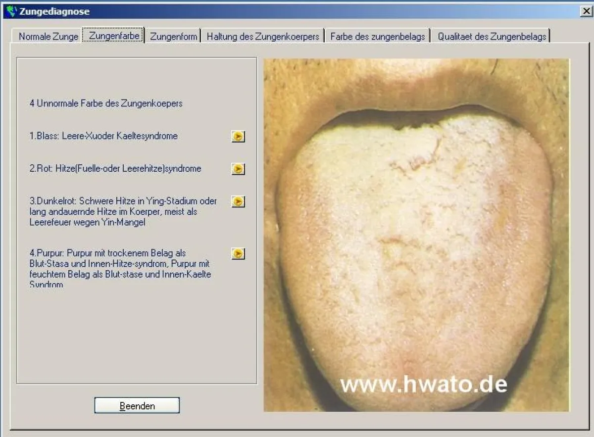 Zungenfotos als Diagnosehilfe zur Orientierung - Therapiesimulation im Menü 