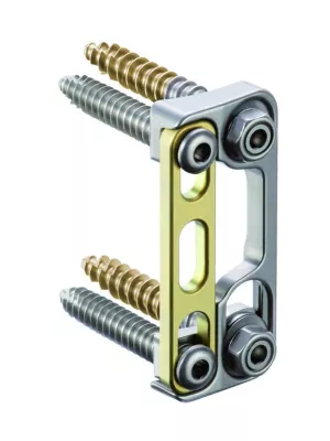 Bild: goldener Zweiteiler – ulrich medical führt 2010 golden gate, ein zweiteiliges Plattensystem, auf dem Markt ein