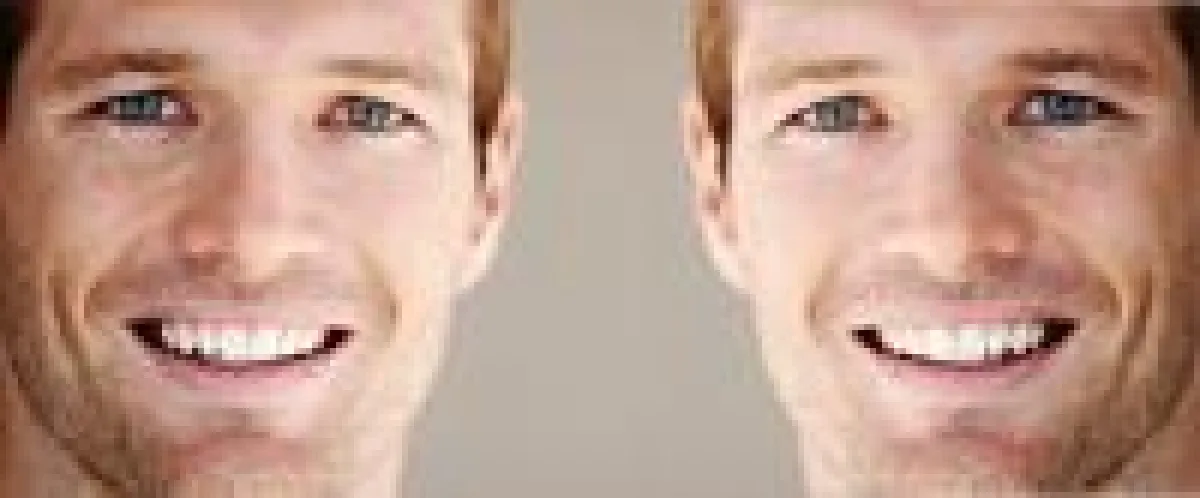 Wen von beiden würden Sie einstellen?