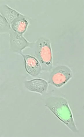 Wie «Schläferzellen» in Krebstumoren zerstört werden können Bild: Wie «Schläferzellen» in Krebstumoren zerstört werden können