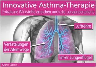 Bild: Innovative Asthma-Therapie