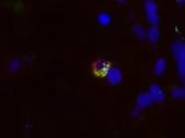 Bild: NITRIERUNG VON PROTEINEN BEEINFLUSST ALLERGISCHE REAKTIONEN