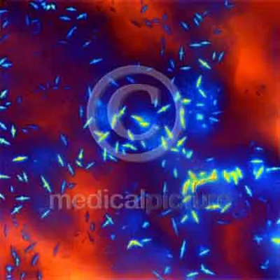 Bild: Insulin hautnah - aussergewöhnliche Mikroaufnahmen bei medicalpicture