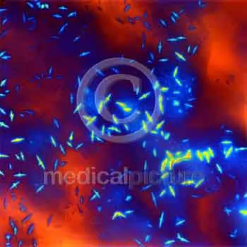 Insulin hautnah - aussergewöhnliche Mikroaufnahmen bei medicalpicture Bild: Insulin hautnah - aussergewöhnliche Mikroaufnahmen bei medicalpicture
