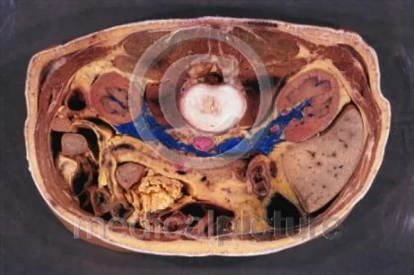 Bild: Die Leber quietsch und eiert medicalpicture Bilderwelten zum Deutschen Lebertag 2006 am 20.11.2006