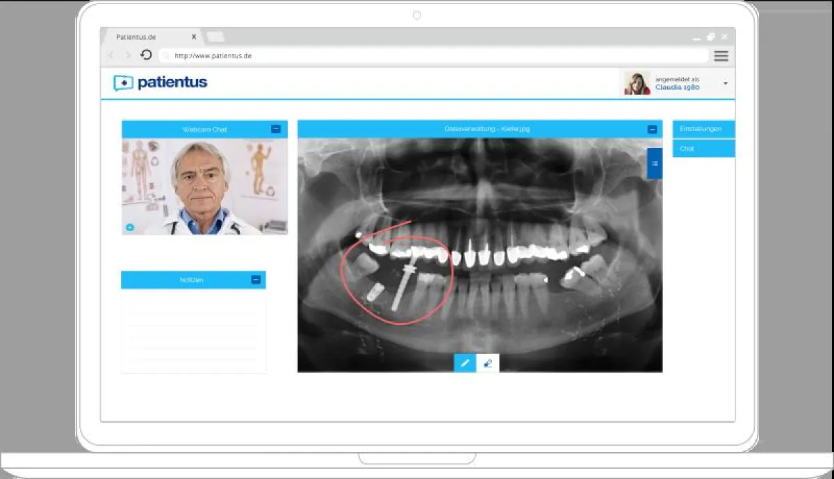 Besprechung von medizinischem Bildmaterial in der Online Sprechstunde bei Patientus