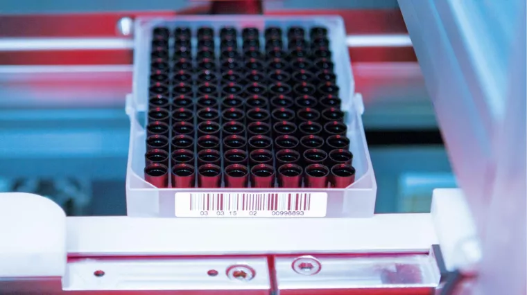 Bild: cab in der Laborautomation: Komponenten für eindeutige Kennzeichnung