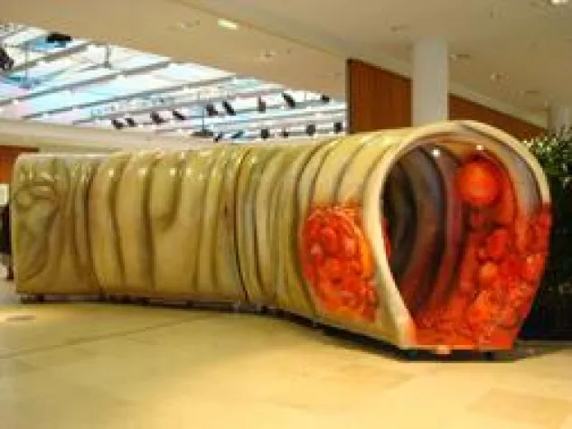 Bild: Infotag zur Darmgesundheit