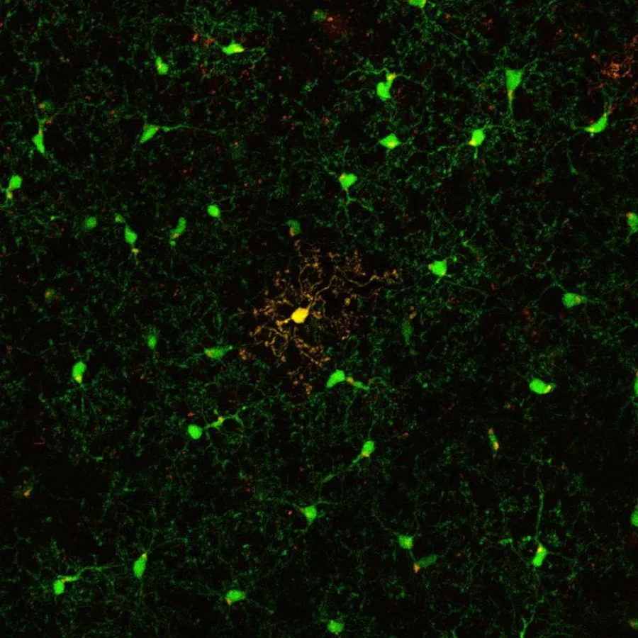 The scientists labelled individual microglial cells (in yellow). This allowed them to differentiate the cells from other microglia (in green) and to follow them over their lifespan in vivo. (Copyright