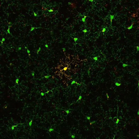 Bild: The brain’s defense cells live longer than expected