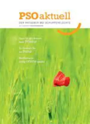 Bild: Wirksame Hilfe gegen Schuppenflechte auf dem Kopf