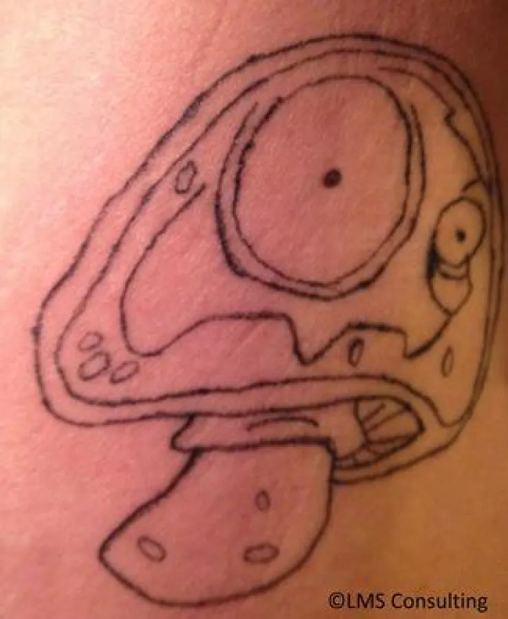 Pilze auf der Haut? Die Wallenstein Klinik kann helfen.