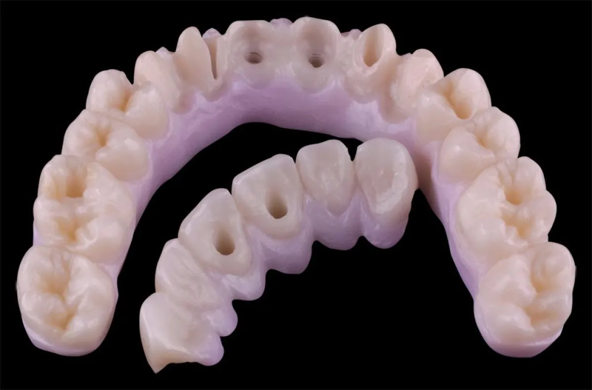 100 % Prettau Zirkon