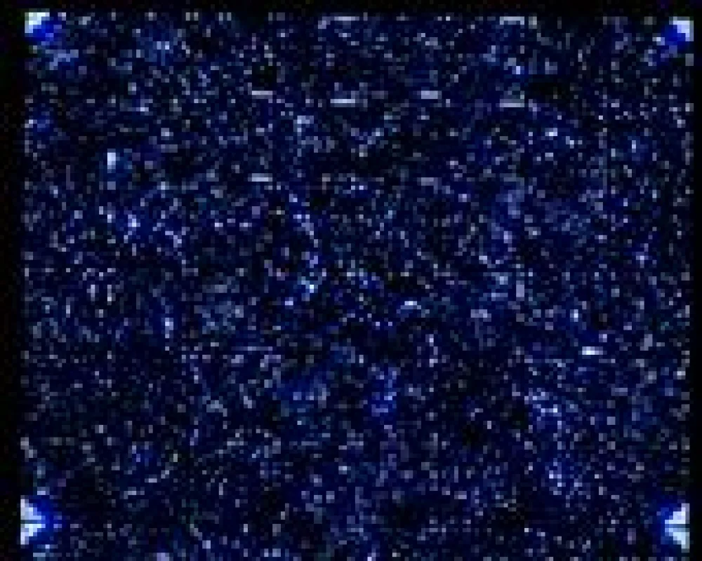 Microarrays messen bis zu 30.000 Genen gleichzeitig. Dank modernster Methoden der Biostatistik können die so gewonnenen Daten effizient analysiert werden.