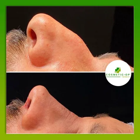 Bild: Schönheits-OP