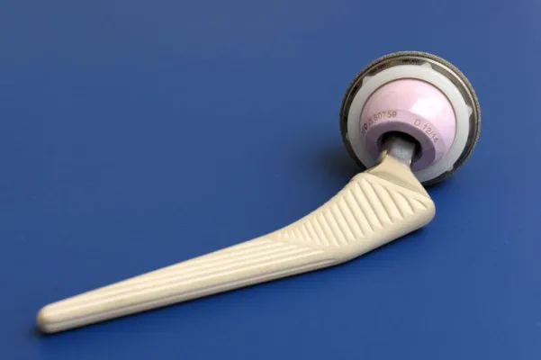 Hüftprothese – so vermeiden Sie eine vorzeitige Wechsel-Operation Bild: Hüftprothese – so vermeiden Sie eine vorzeitige Wechsel-Operation