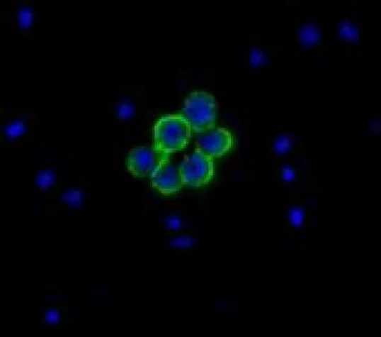 Bild: Krebstherapie kennt kein Einheitsrezept(or)