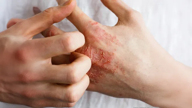 Nino Mai Arbeitsschutz GmbH: Hautschutz für die Immobilienbranche Bild: Nino Mai Arbeitsschutz GmbH: Hautschutz für die Immobilienbranche