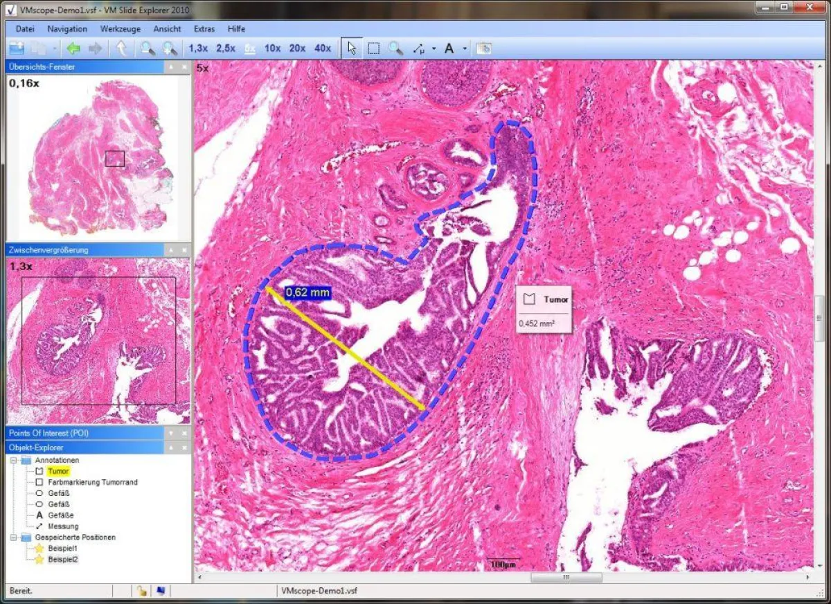 VM Slide Explorer Software der VMscope GmbH